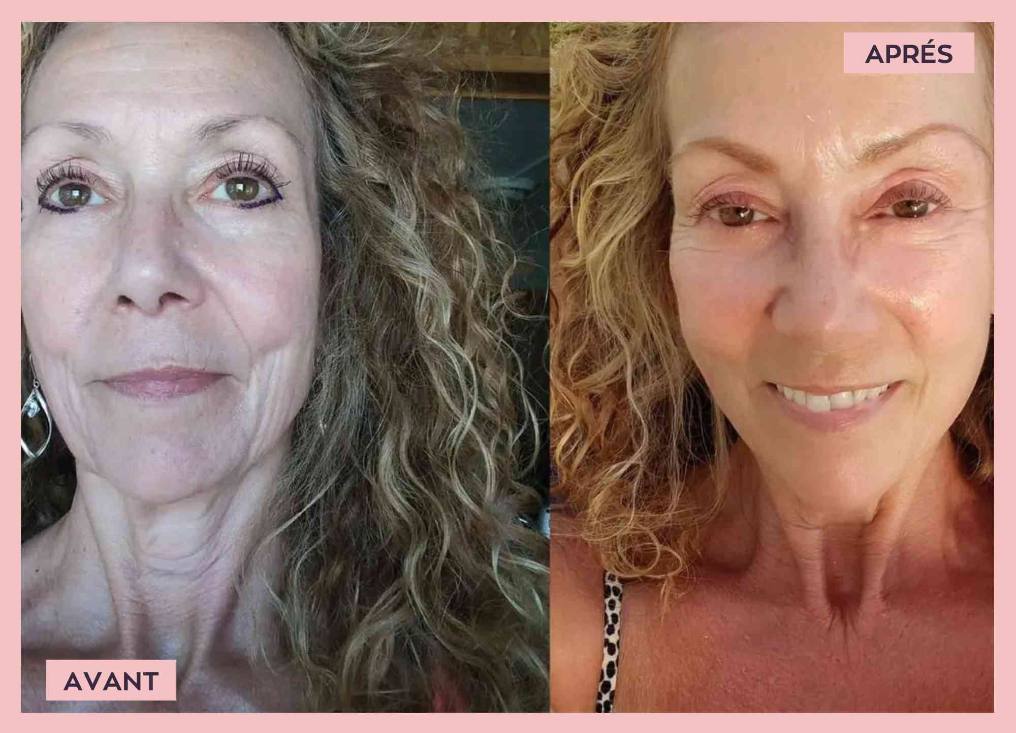 //afrique.elevaine.co/cdn/shop/files/highcompress_AVANT_1.jpg?v=1717354902